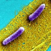  Biofilms are communities of bacteria (E. coli are depicted here in purple) ensconced in a slimy, but extremely tough matrix of extracellular material.  Image credit  goes to: Harvard's Wyss Institute