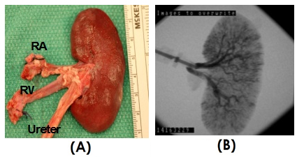 (A) The explanted engineered porcine kidney construct from implantation. (B) Fluoroscopic angiogram image to demonstrate vascular patency of the harvested kidney construct. Renal artery (RA) and renal vein (RV).