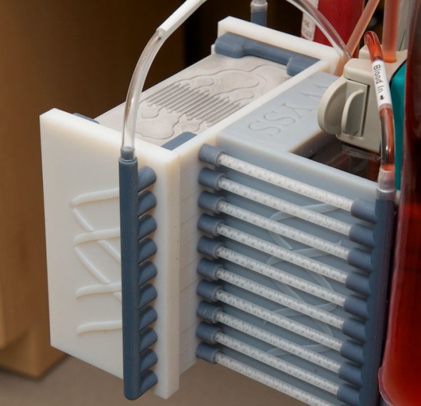 The Spleen-on-a-chip, developed at the Wyss Institute, will be used to treat bloodstream infections that are the leading cause of death in critically ill patients and soldiers injured in combat. Image credit goes to: Wyss Institute