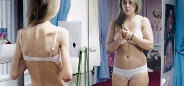 eating disorder mirror