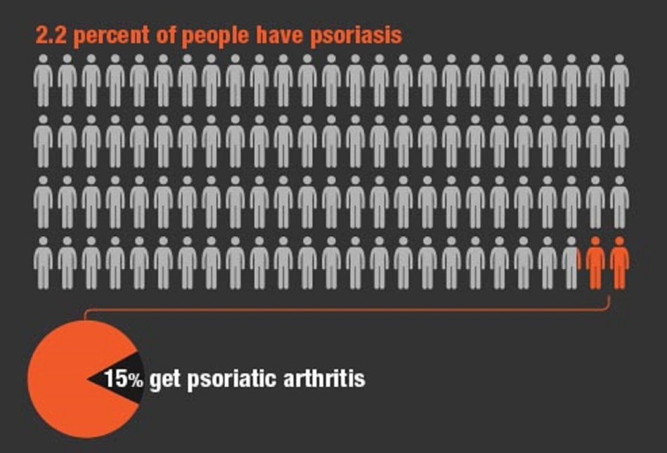psoriasis