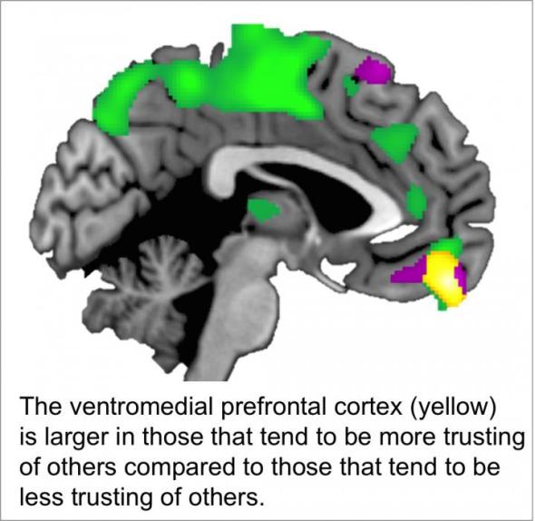he ventromedial prefrontal cortex (yellow) is larger in those that tend to be more trusting of others compared to those that tend to be less trusting of others. Image credit goes to: Brian Haas/University of Georgia