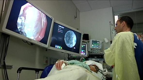 endovascular clot removal