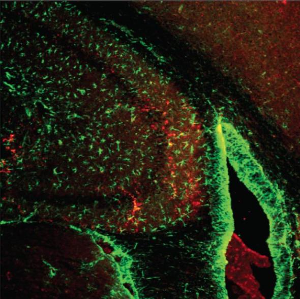 Estrogen-Related Receptor gamma protein