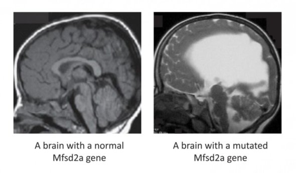 researchers find essential fat for brain growth