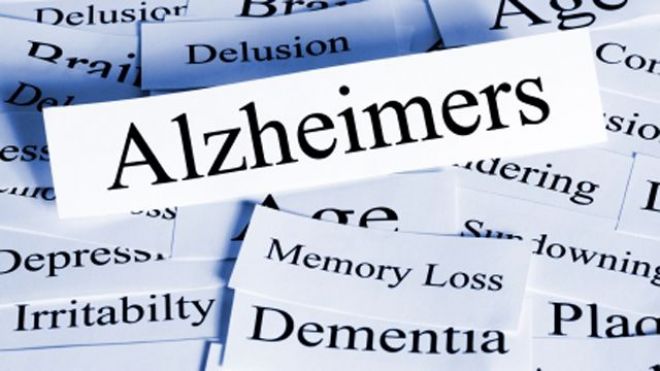 Alzheimers