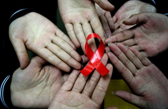 HIV particles do not cause AIDS, our own immune cells do