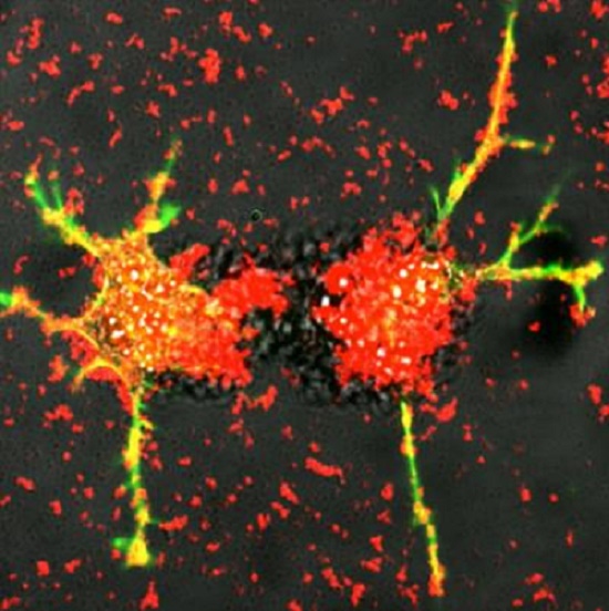 UNC smart cells teach neurons damaged by Parkinson's to heal themselves
