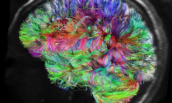 LSD changes consciousness by reorganizing human brain networks