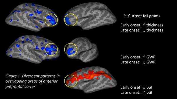 FMRI showing effects of marijuana and age