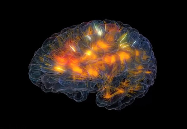 Neuron connections in the brain
