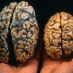 brain sizes