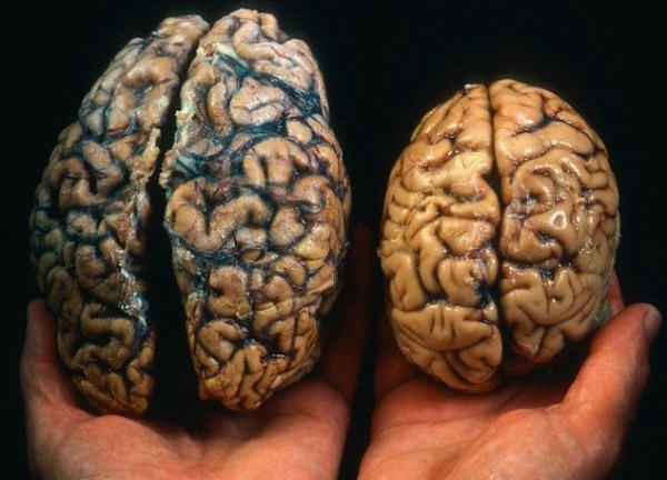 brain sizes
