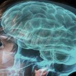 traumatic brain injury