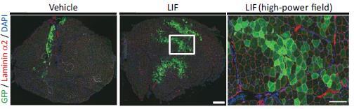 Representative immunohistochemistry of GFP-positive fibers in transplanted muscles at two weeks after transplantation. Newly grown muscle fibers formed by transplanted cells appear in green. The amount of fibers in the LIF-treated muscles is much greater than in the untreated (vehicle) muscles. Low-power field images were shown in left and center. Scale bar: 300 μm. High-power field image was shown in right. Scale bar: 100 μm. Image credit goes to: IOS Press, 2016