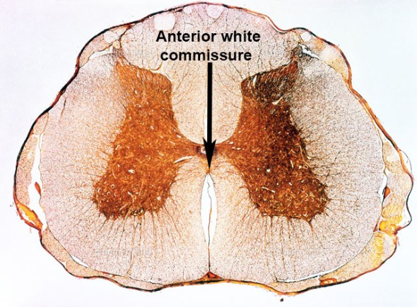 The anterior white commissure