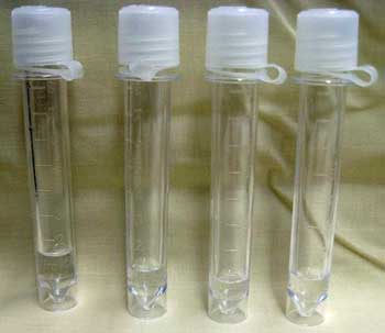 cerebrospinal fluid