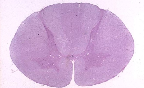 human cervical spinal cord cross section