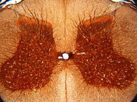 cross section of spinal cord