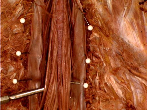 Cuada equina disection