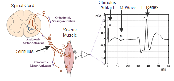 H-reflex pathway and the measured response