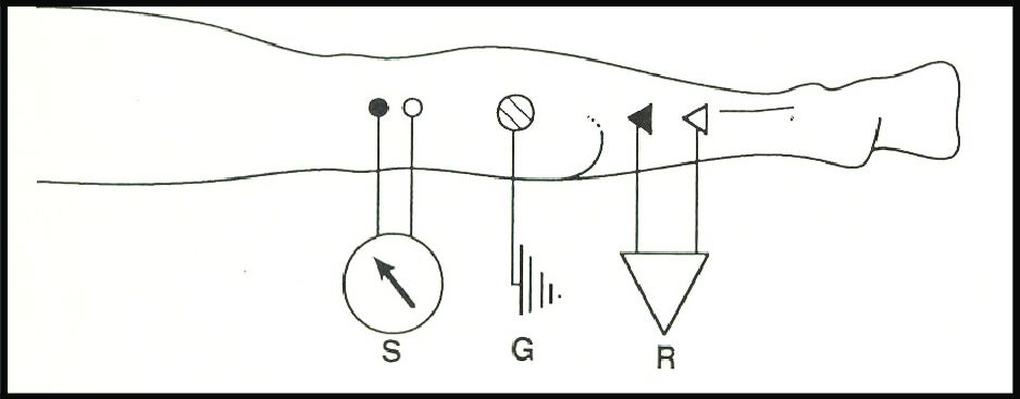 Diagram showing how we measure the H-reflex
