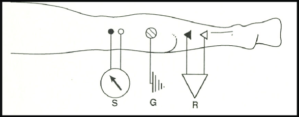 Diagram showing how we measure the H-reflex
