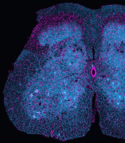 Mitochondria in a spinal cord section
