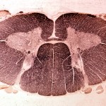 Cervical spinal cord cross-section