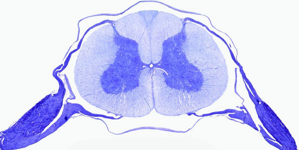Transverse human spinal cord slice stained