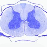Transverse human spinal cord slice stained