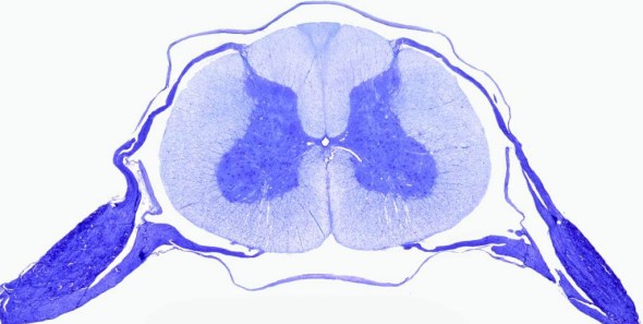 Transverse human spinal cord slice stained