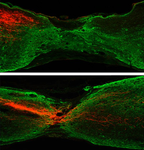 Spinal cord axon repair