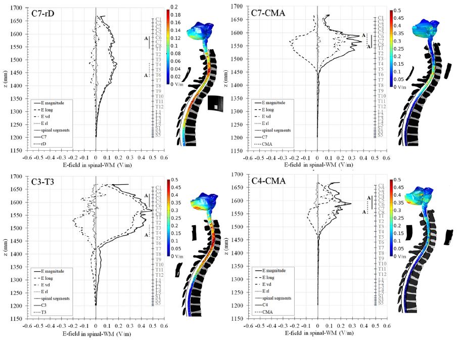 Cervical trans-spinal direct current stimulation - Fig. 3