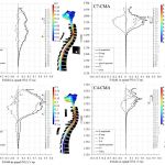 Cervical trans-spinal direct current stimulation - Fig. 3
