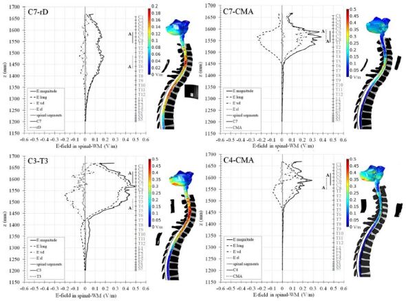 Cervical trans-spinal direct current stimulation - Fig. 3