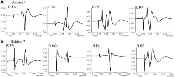 Neuron action potential