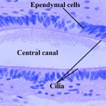 ependymal cells
