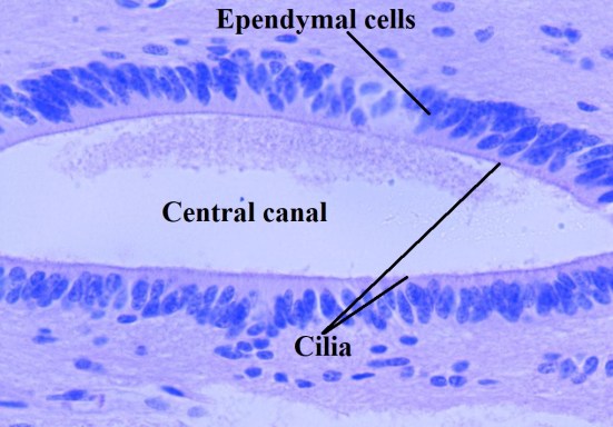 ependymal cells