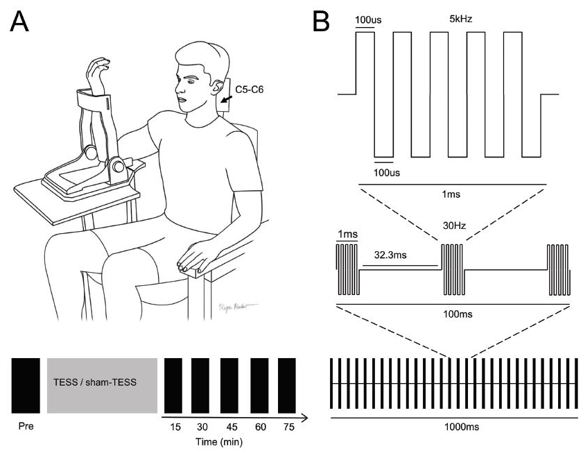 Figure 1 of the paper showing the experimental set-up and the type of pulse used for stimulation