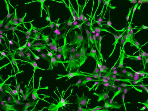 human astrocytes