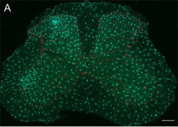 activated microglial cells in damaged L4 segment of spinal cord