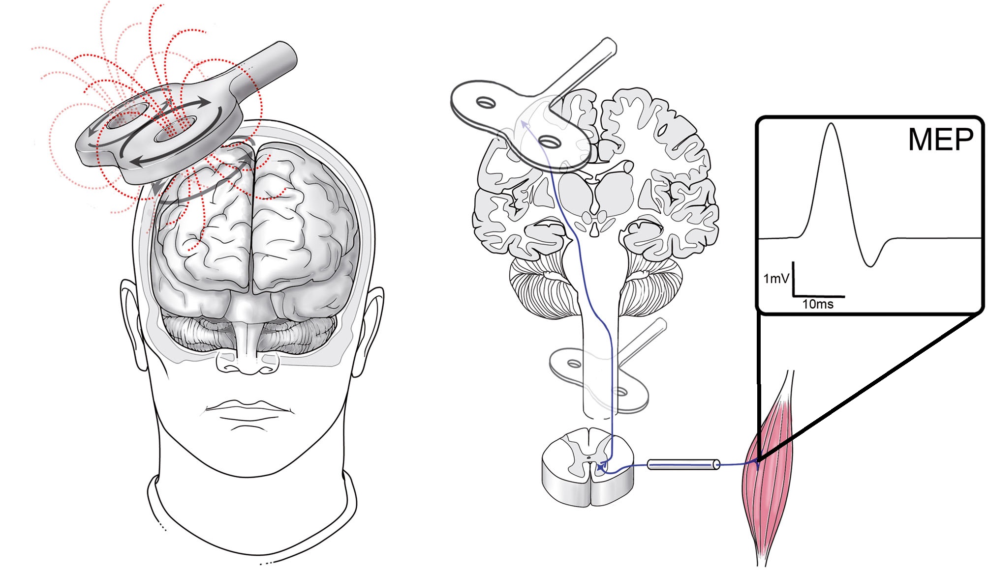 Transcutaneous magnetic stimulation of the brain