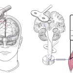Transcutaneous magnetic stimulation of the brain