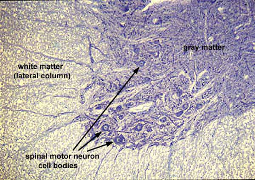 motor neuron histology