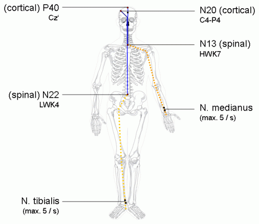 Somatosensory Evoked Potential