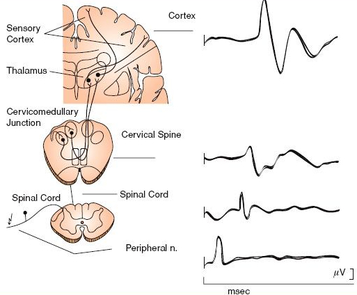 Somatosensory Evoked Potentials