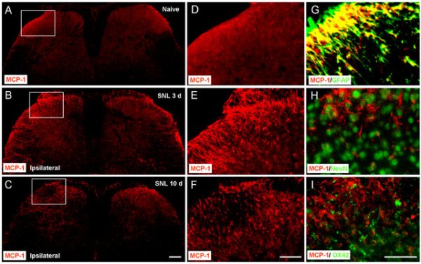upregulated spinal cord astrocytes