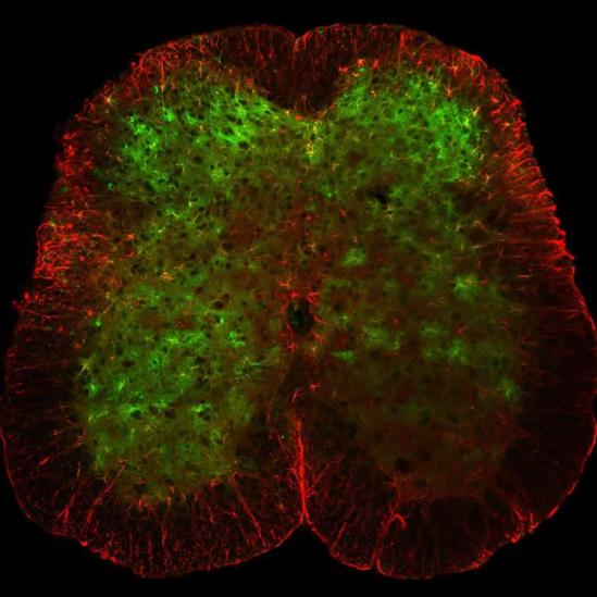 spinal cord astrocytes