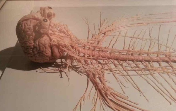 whole brain and spinal cord dissected